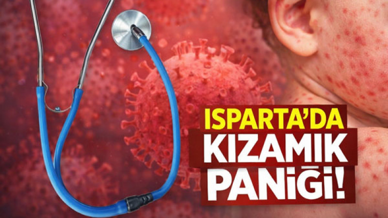 Isparta’da Kızamık Paniği: Sağlık Ekipleri Alarmda!